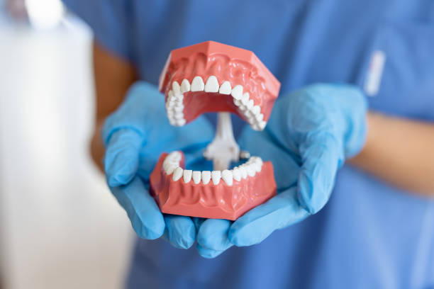 Fixed Bridge Dental Implants for Multiple Missing Teeth: Benefits and Options